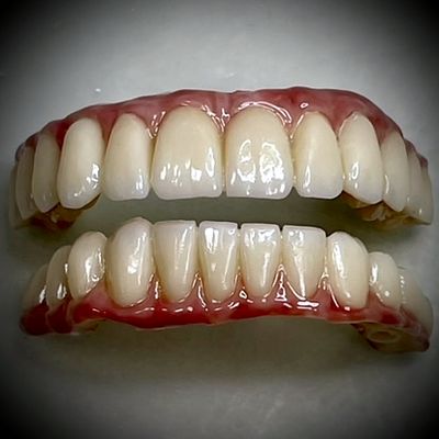 Upper and lower All-on-X prostheses