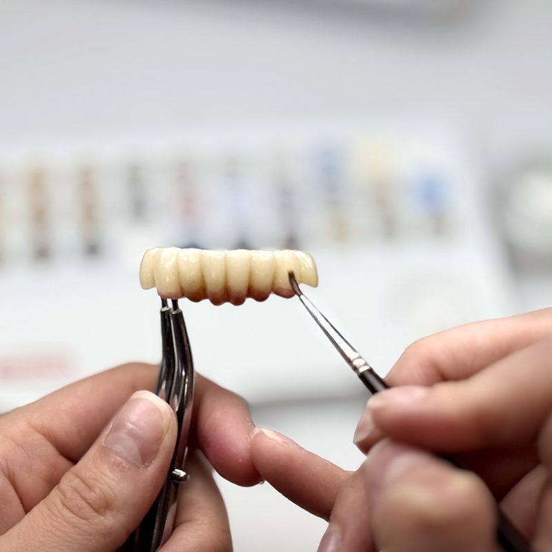 Technician hands holding a zirconia bridge with tweezers during custom staining