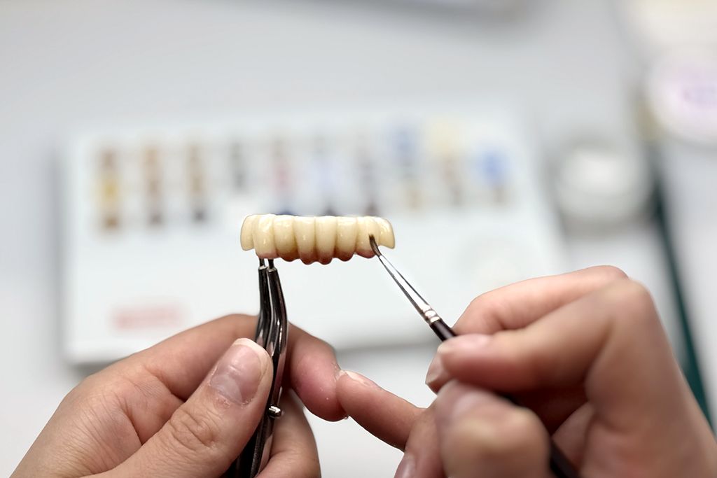 Technician hands holding a zirconia bridge with tweezers during custom staining